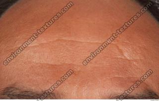 human skin wrinkled 0005